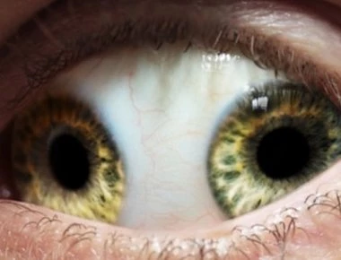 Οι 10 πιο παράξενες ασθένειες στην ιστορία της Ιατρικής! (βίντεο)